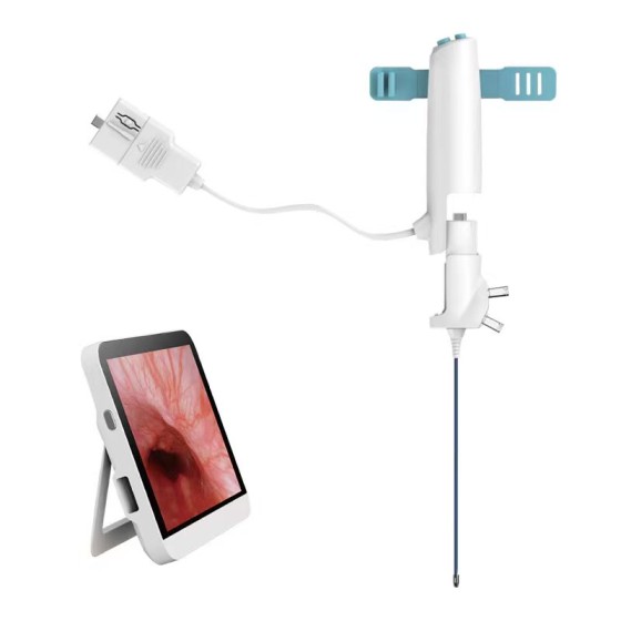 無創一次性電子內窺鏡用於保膽結石取出