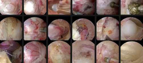 International Enrollment Form for UBE Surgery Training