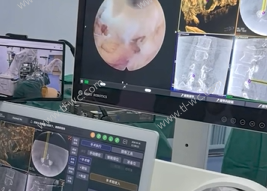 Spine surgery robot lanzado