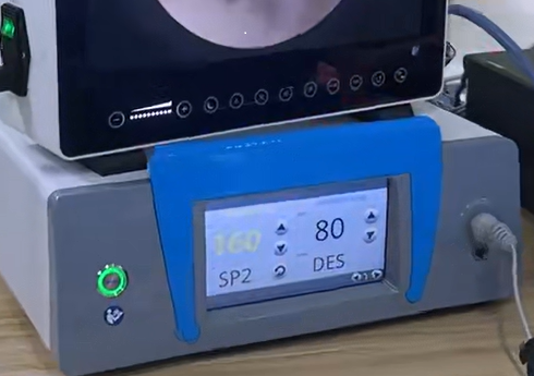 UBE hat einen merkzettel zur anmeldung für die anmeldung zur teilnahme gegeben